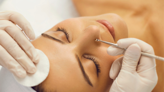 Resultado Limpeza de Pele 1